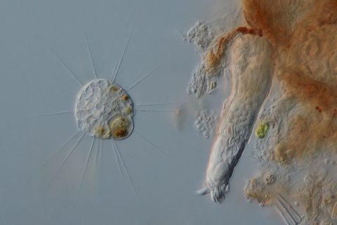 Ein R&auml;dertier neben einem Sonnentierchen / Bdelloidea und Heliozoa