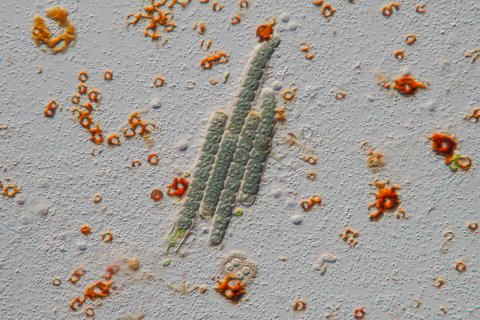 Blaualgen im See in Deutschland