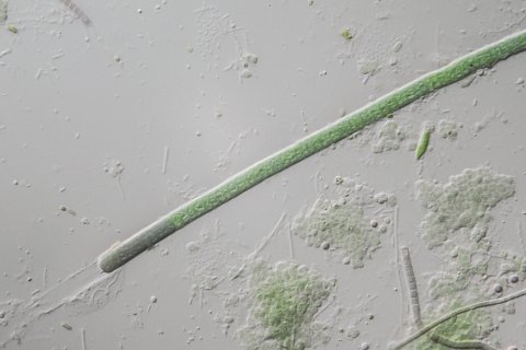 cyanobakterien unter dem mikroskop