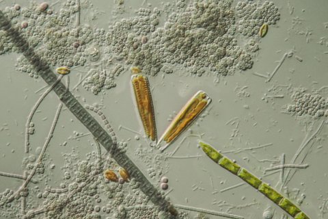 Echte Algen und Blaualgen auf einem besiedelten Objekttr&auml;ger.