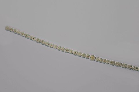 cyanobakterien mit heterocysten und zellf&auml;den