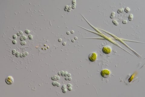 Bakterien, Blaualgen und Gr&uuml;nalgen unter dem Mikroskop