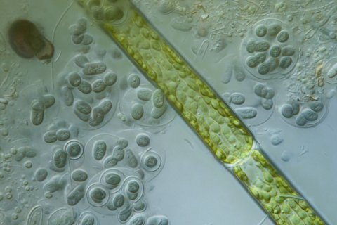 Blaualgen mit Schleimh&uuml;lle im See