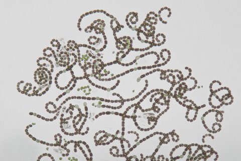 giftige blaualgen aus einem see