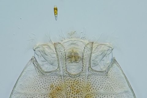 the rotifer Platyias quadricornis
